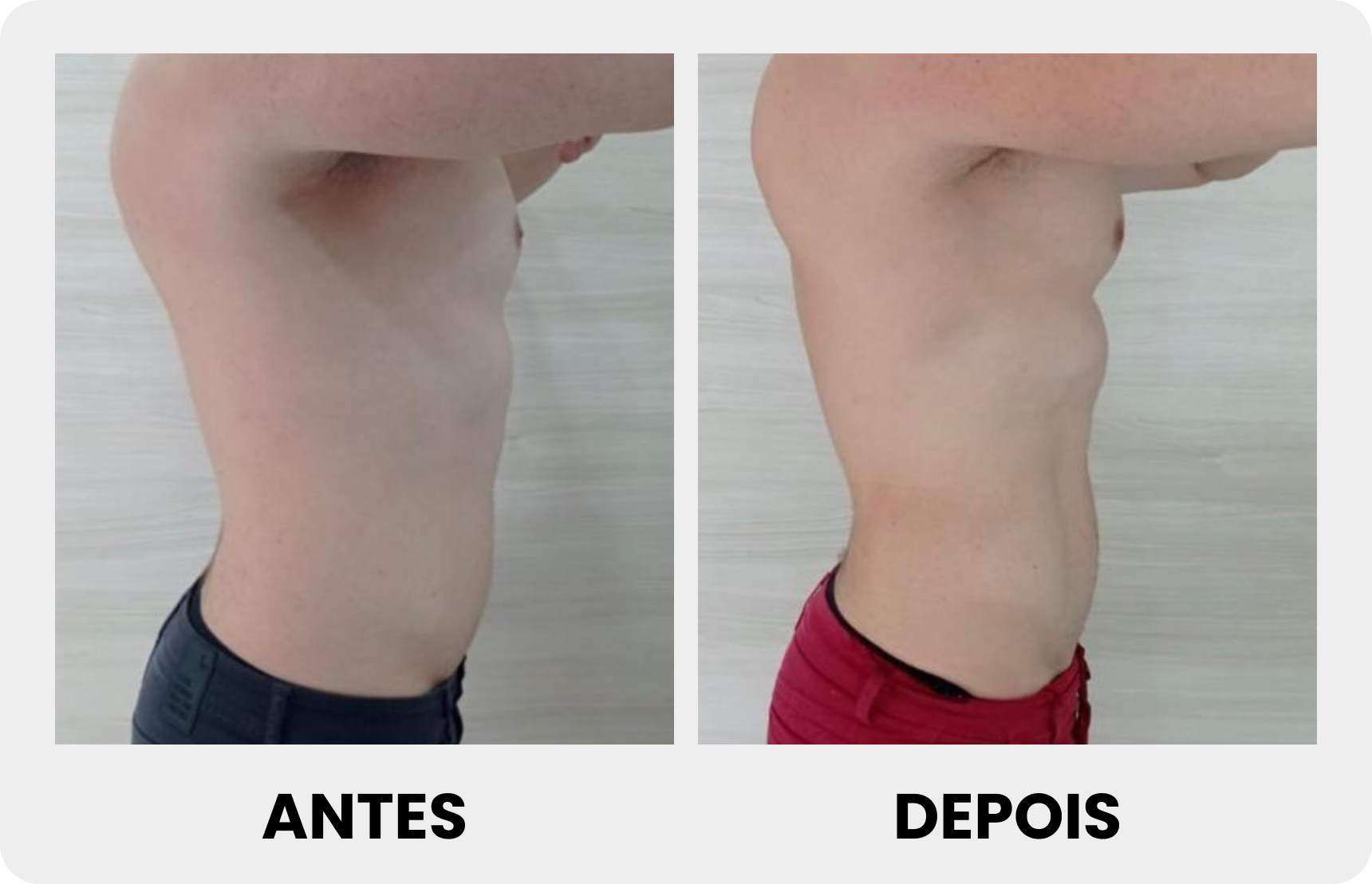 Antes 1