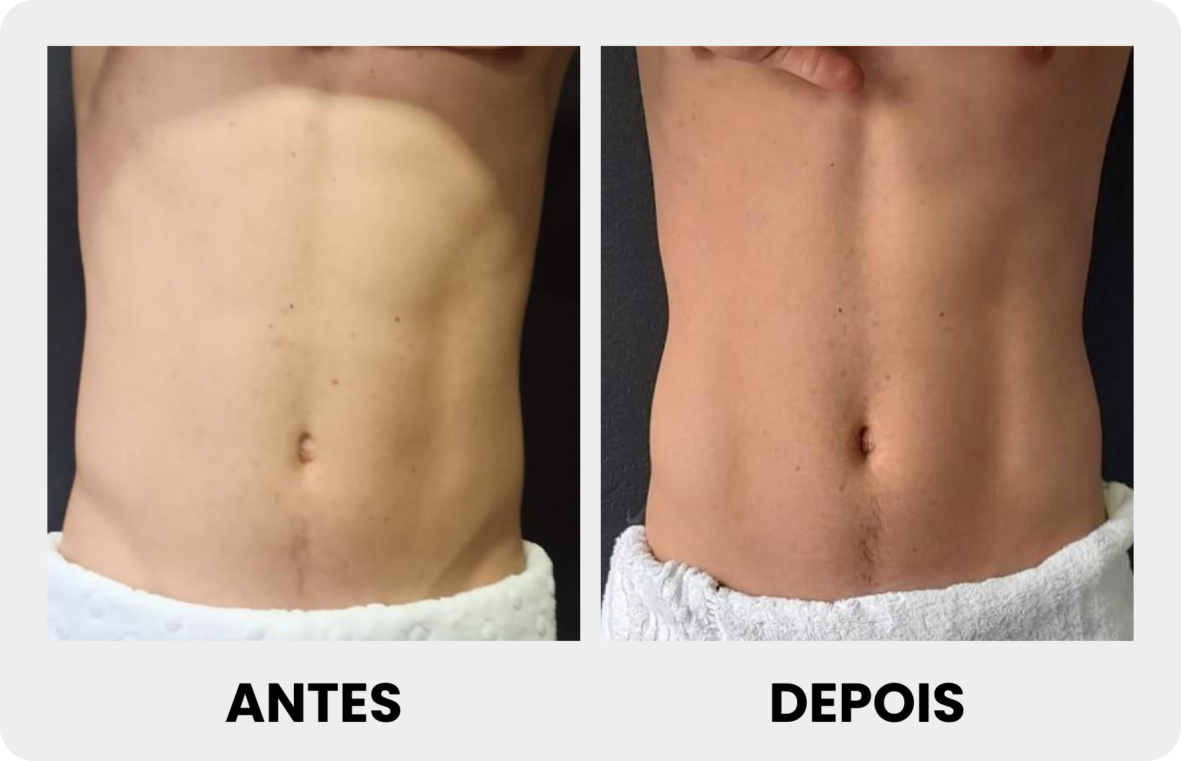Antes 2