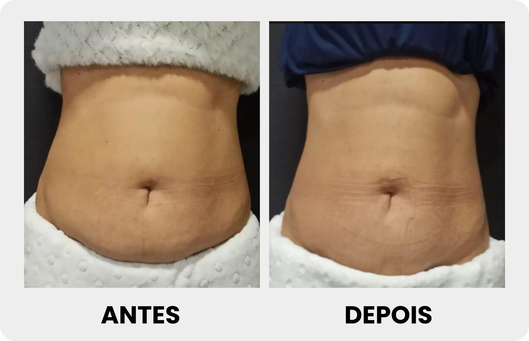Antes 3