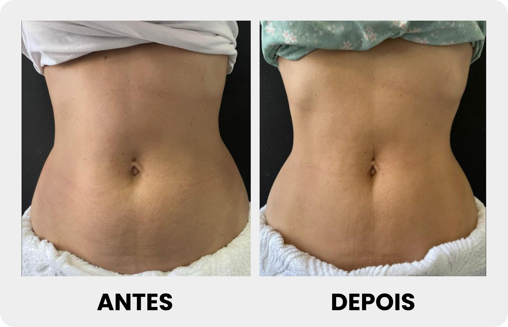 Antes 4