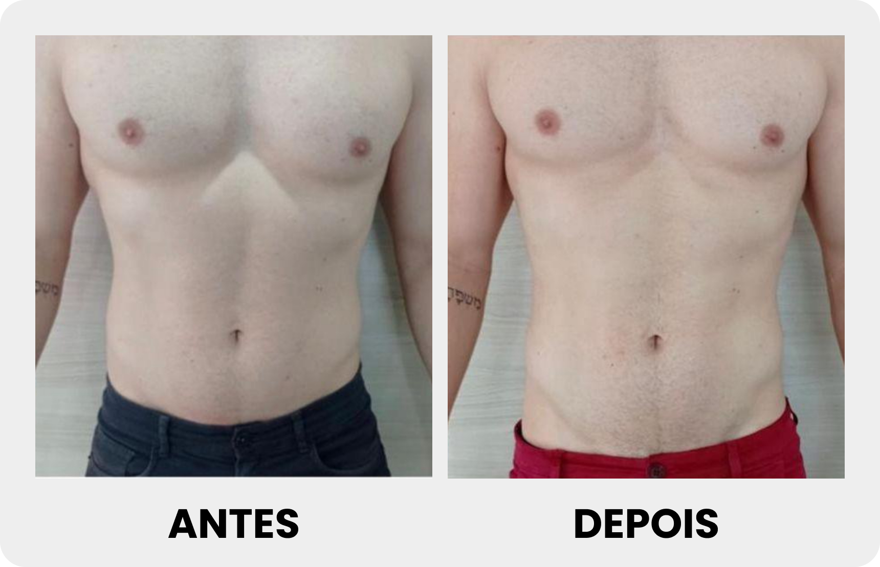 Antes 5