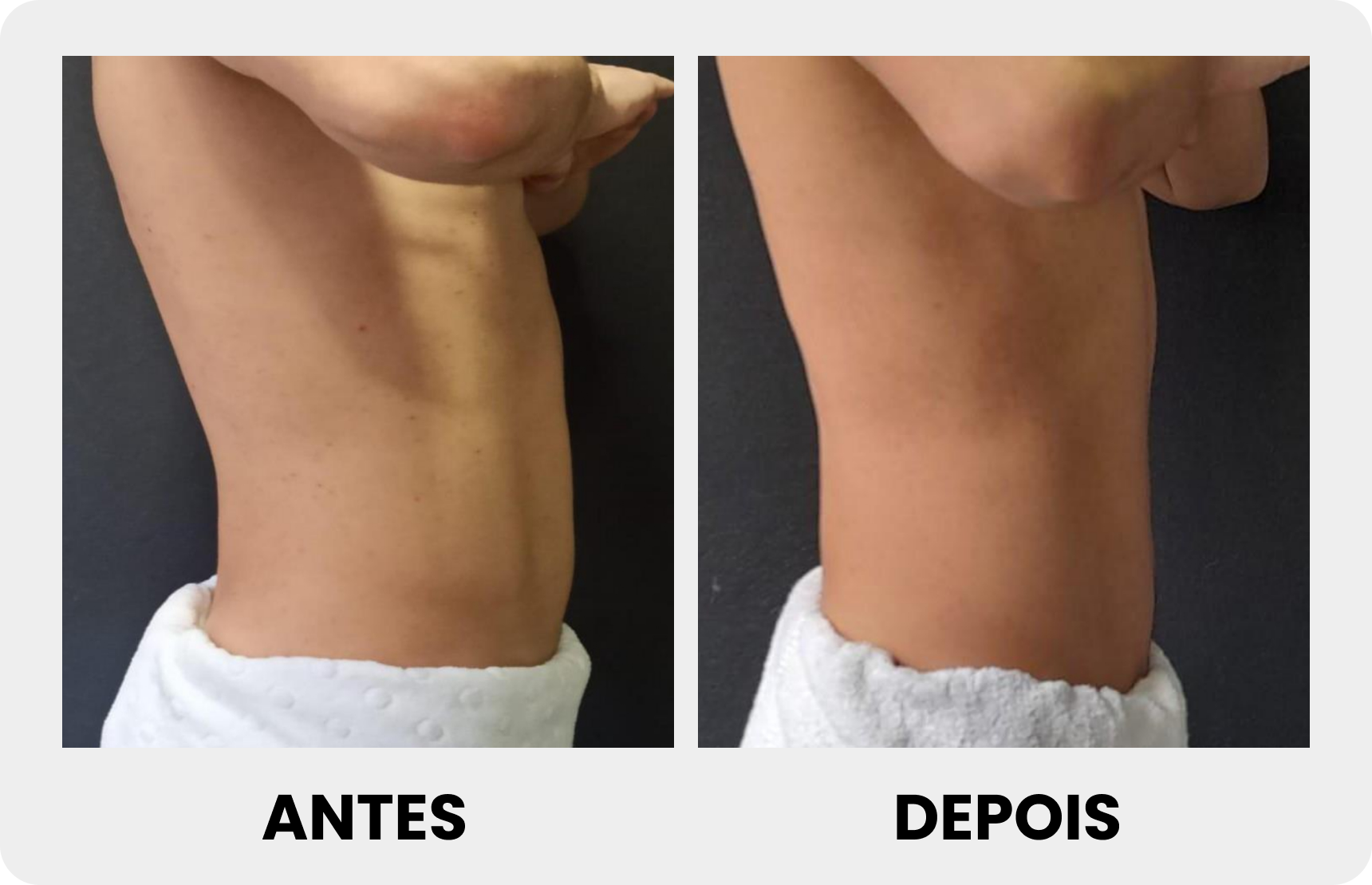 Antes 6